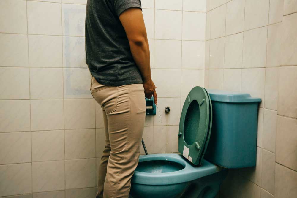 ঘন ঘন প্রস্রাব (frequent urination)