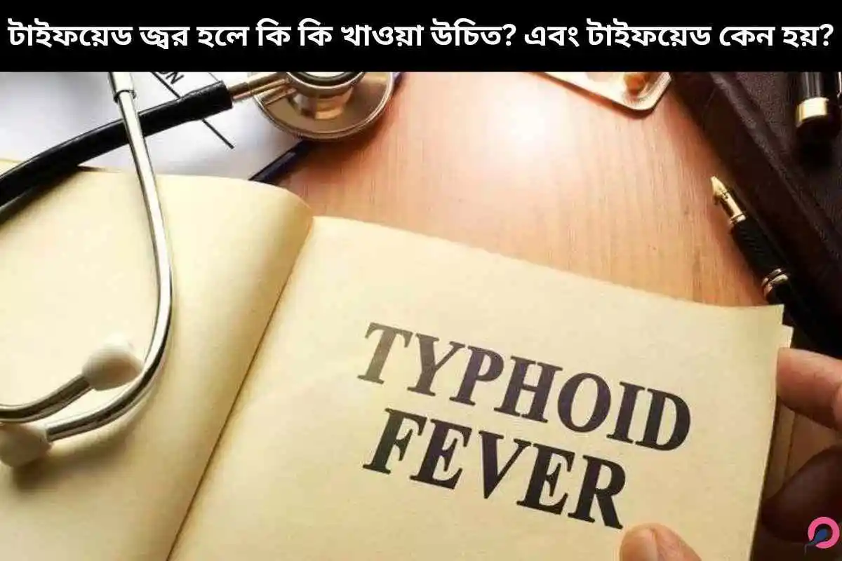 টাইফয়েড জ্বর হলে কি কি খাওয়া উচিত? এবং টাইফয়েড কেন হয়?