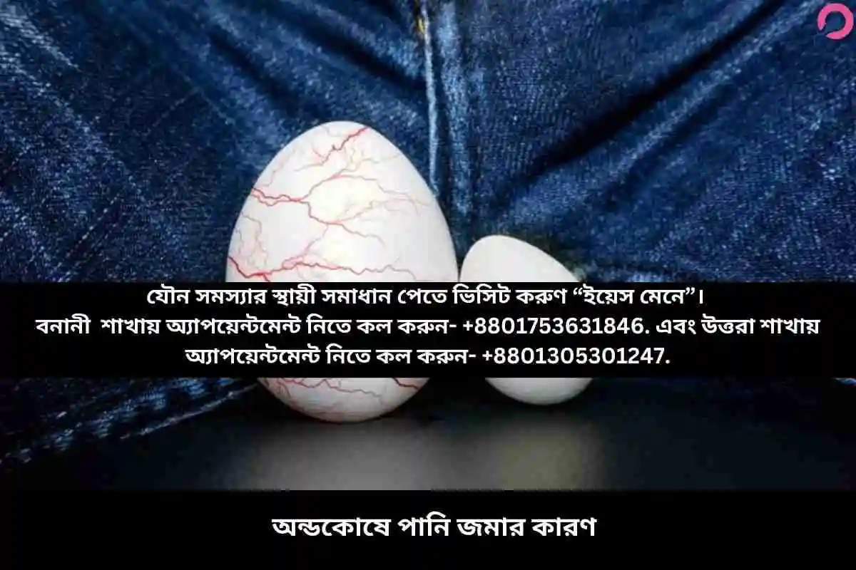 অন্ডকোষে পানি জমার কারণ